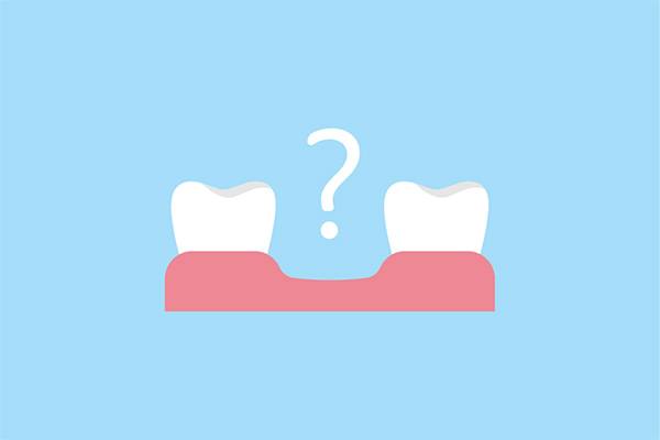 Options for Replacing Missing Teeth After a Dental Emergency from Comprehensive Dental Science, PC in New York, NY