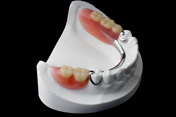 Options for Replacing Missing Teeth: Are Partial Dentures Easier to Care for Than Dentures? from Comprehensive Dental Science, PC in New York, NY